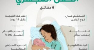 تكلفة عملية الحقن المجهري